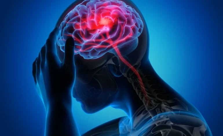 5 Jenis Penyakit Stroke: Kenali Penyebab dan Bahayanya